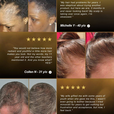 Golden Oil — Anti-Shedding Scalp Treatment