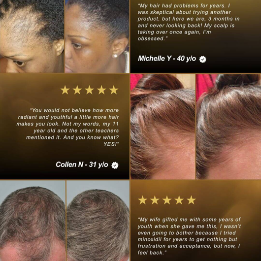 Golden Oil — Anti-Shedding Scalp Treatment